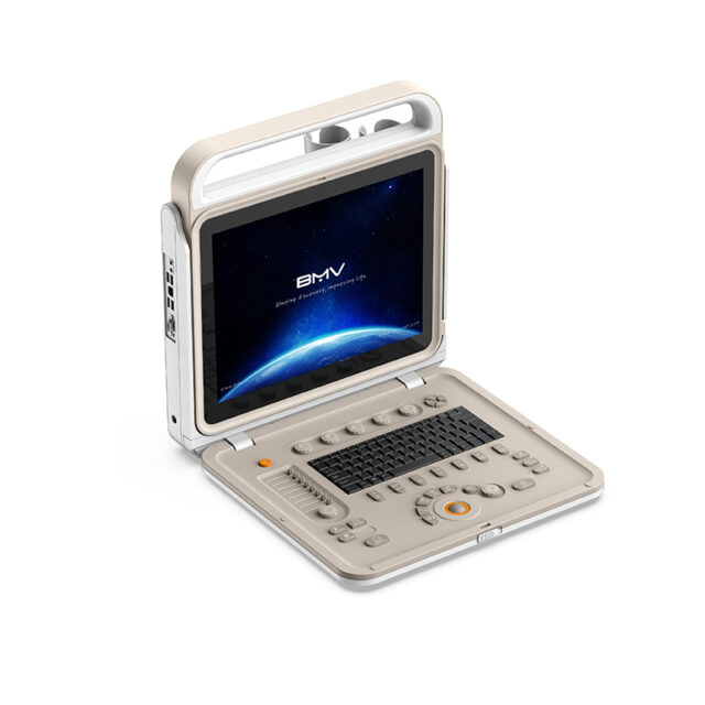 BPU58 Portable Color Doppler Ultrasound(Color Doppler System Improve Patient Care Quality)