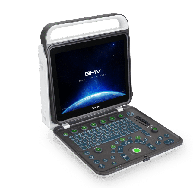 BPU60C Advanced Color Doppler Ultrasound Scanner System(64 Channels/Providing Comprehensive and Efficient Diagnoses)